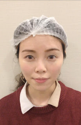Ceci 分享 一枝TEOSYAL熊貓針~輕鬆消滅黑眼圈淚溝眼袋眼紋 11 Ceci Teosyal 10
