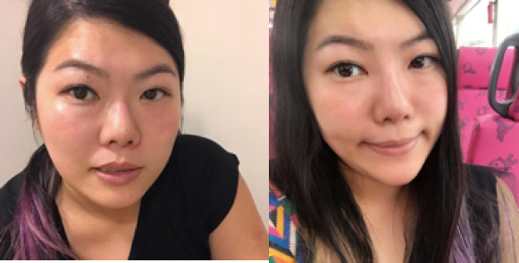 黃金比例系列:打破「眼大鼻高就是美」的迷思:達至完美五官,你需要記住這3個名字— Teosyal、Cleviel、PCL Hiko! 5 2