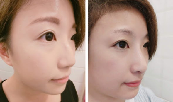 黃金比例系列:打破「眼大鼻高就是美」的迷思:達至完美五官,你需要記住這3個名字— Teosyal、Cleviel、PCL Hiko! 7 4